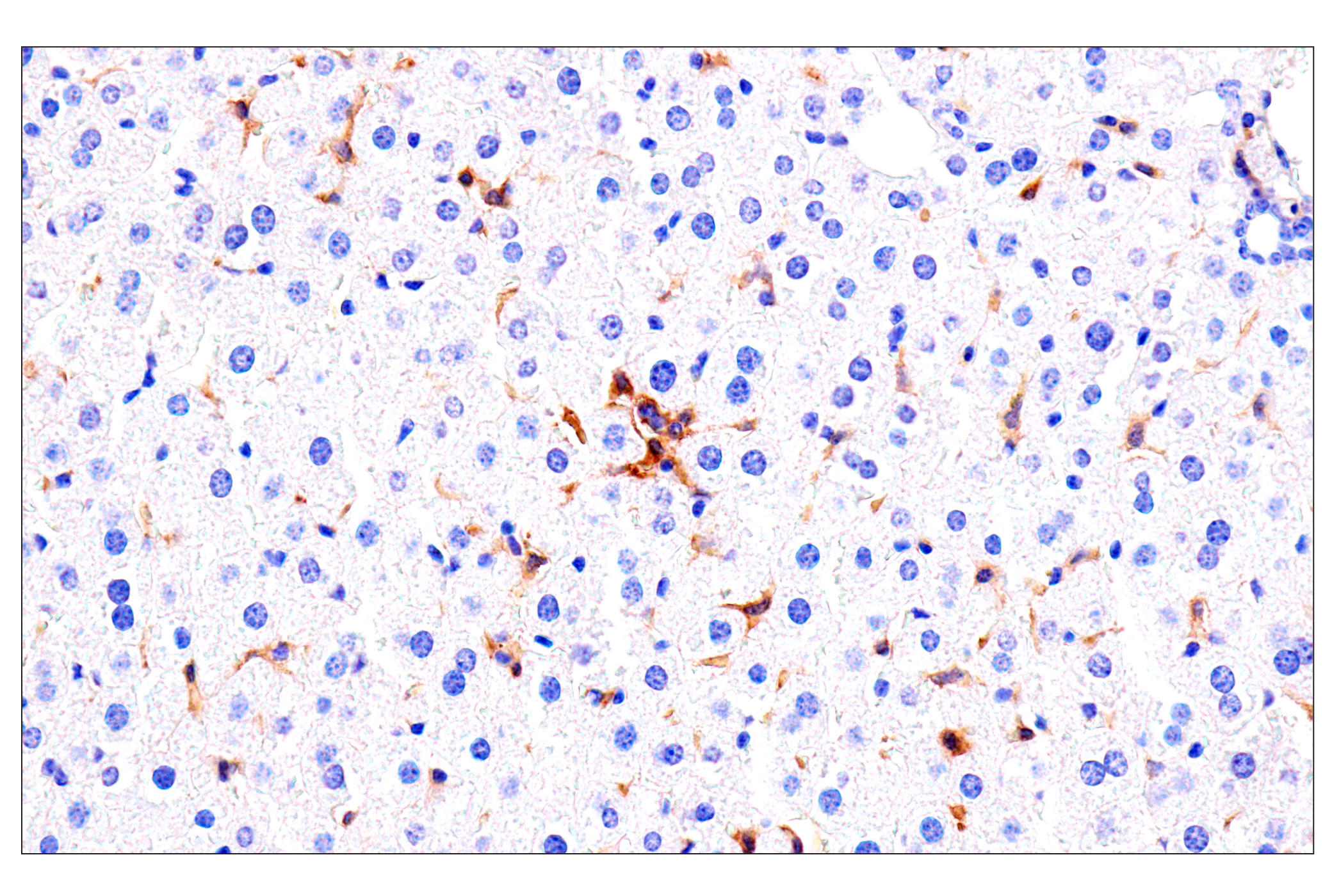 Immunohistochemistry Image 4: Axl (E3Z2H) Rabbit mAb (BSA and Azide Free)