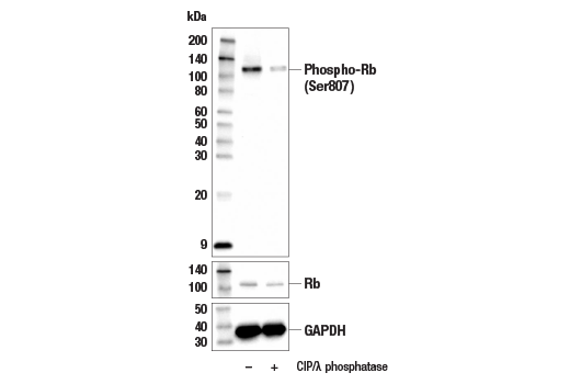 Western Blotting Image 1: Phospho-Rb (Ser807) Antibody