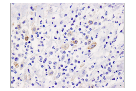 Immunohistochemistry Image 3: PD-L2 (D7U8C™) XP® Rabbit mAb (BSA and Azide Free)