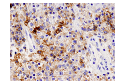 Immunohistochemistry Image 1: PD-L2 (D7U8C™) XP® Rabbit mAb (BSA and Azide Free)