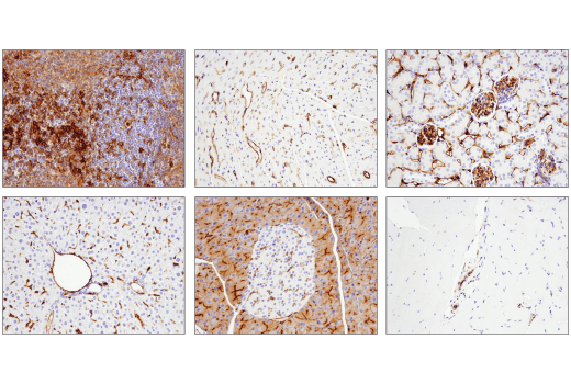 Immunohistochemistry Image 1: CD39/NTPDase 1 (E2X6B) XP® Rabbit mAb (BSA and Azide Free)