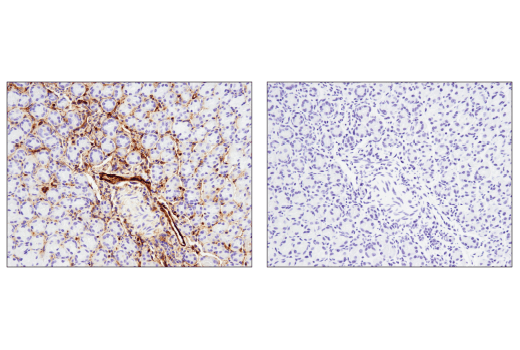 Immunohistochemistry Image 2: CD39/NTPDase 1 (E2X6B) XP® Rabbit mAb (BSA and Azide Free)