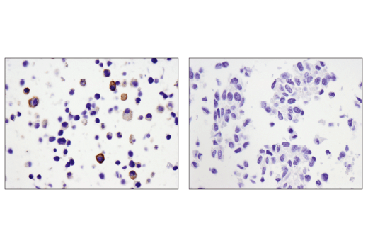 Immunohistochemistry Image 3: CD39/NTPDase 1 (E2X6B) XP® Rabbit mAb (BSA and Azide Free)