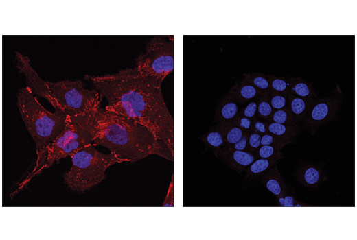Immunofluorescence Image 1: N-Cadherin (D4R1H) XP® Rabbit mAb (Alexa Fluor® 647 Conjugate)