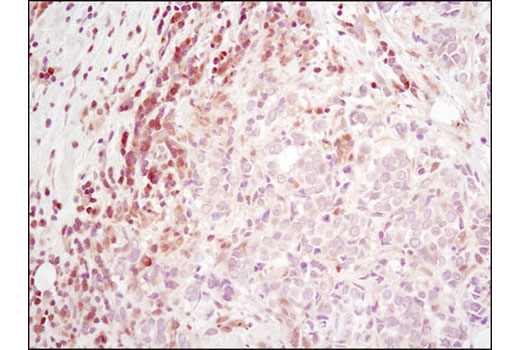 Immunohistochemistry Image 1: RSK2 (D21B2) XP® Rabbit mAb (BSA and Azide Free)