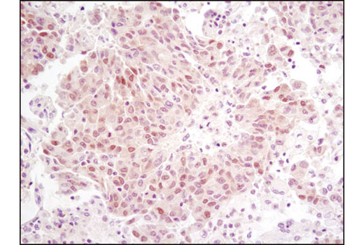 Immunohistochemistry Image 2: RSK2 (D21B2) XP® Rabbit mAb (BSA and Azide Free)