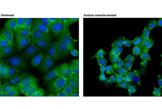 Immunofluorescence Image 1: RSK2 (D21B2) XP® Rabbit mAb (BSA and Azide Free)