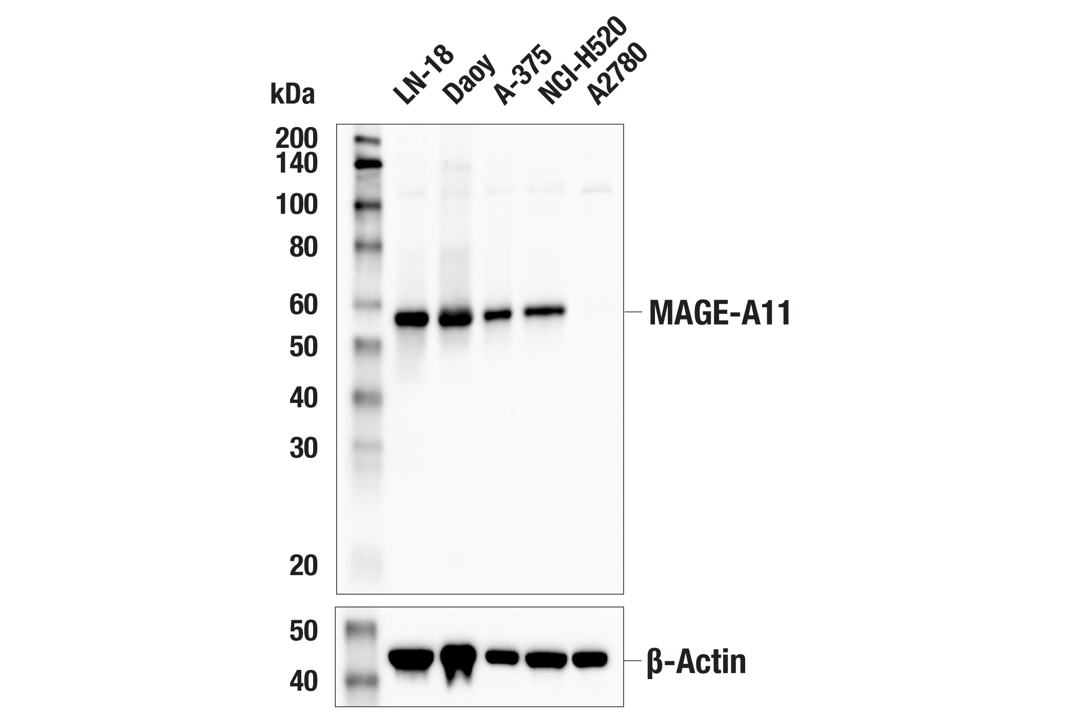 MAGE-A11 (E2F1K) Rabbit mAb | Cell Signaling Technology