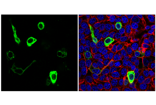 Immunofluorescence Image 1: SARS-CoV-2 Spike Protein (S1) (E5S3V) Rabbit mAb