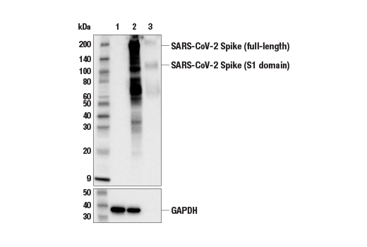 Western Blotting Image 3: SARS-CoV-2 Spike Protein (S1) (E5S3V) Rabbit mAb