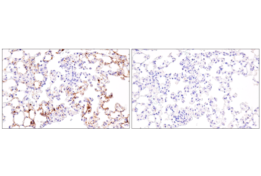Immunohistochemistry Image 2: SARS-CoV-2 Spike Protein (S1) (E5S3V) Rabbit mAb