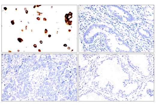 Immunohistochemistry Image 3: SARS-CoV-2 Spike Protein (S1) (E5S3V) Rabbit mAb