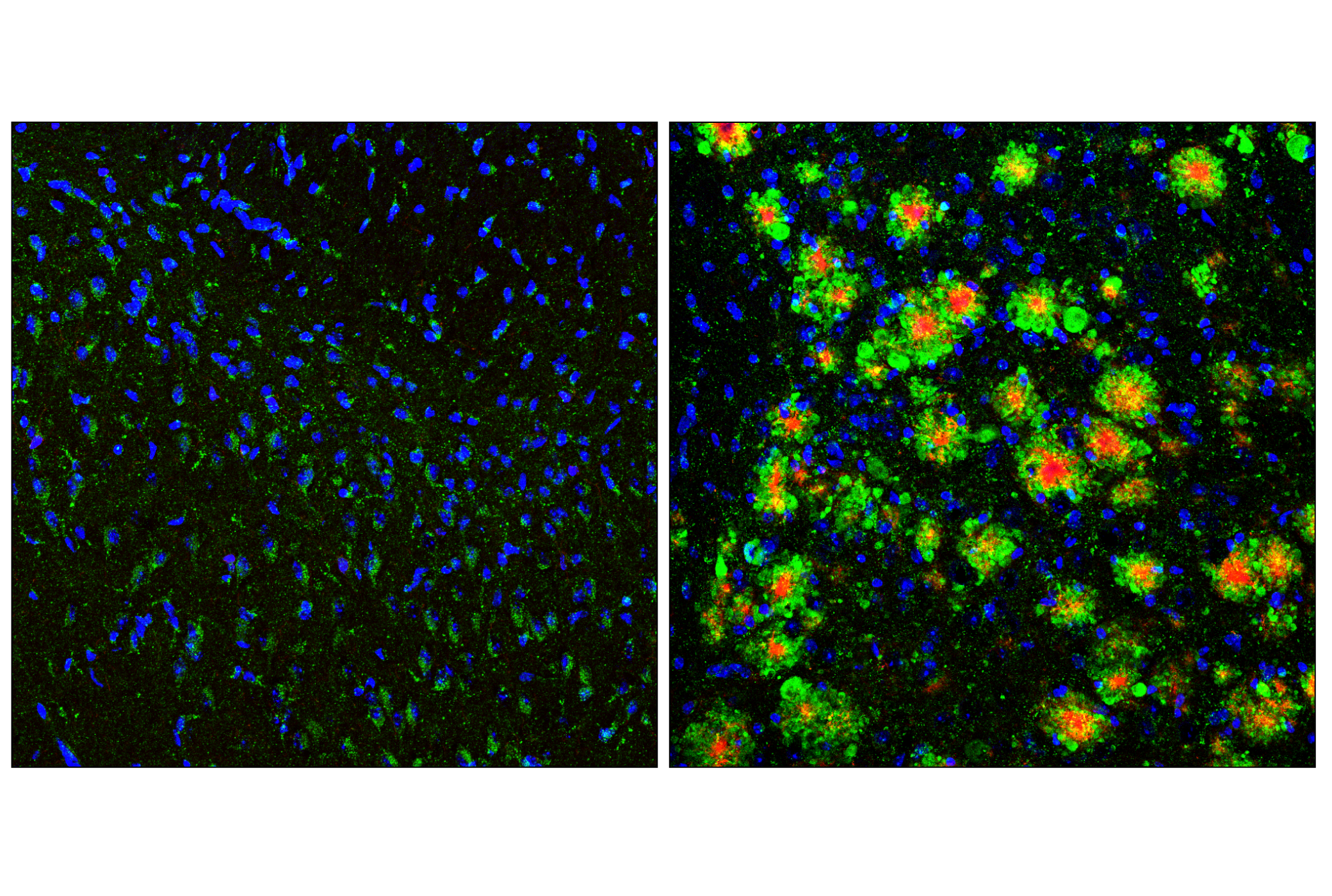 Immunofluorescence Image 1: LAMP1 (E5N9Z) Rabbit mAb