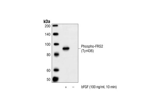  Image 1: Basic Fibroblast Growth Factor (bFGF)