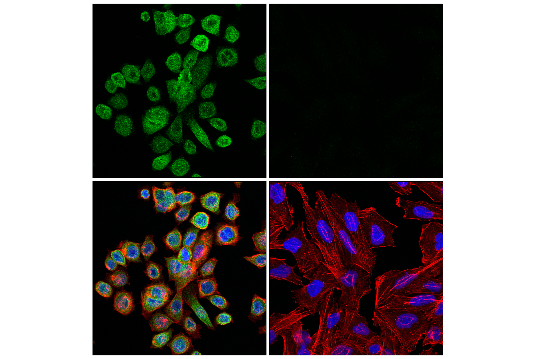 Immunofluorescence Image 1: UNC93B1 (E5H3O) Rabbit mAb