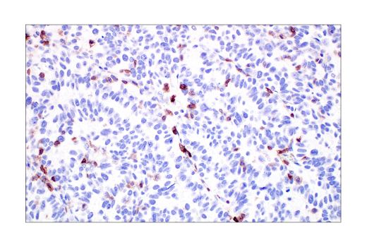  Image 40: Human Exhausted CD8+ T Cell IHC Antibody Sampler Kit