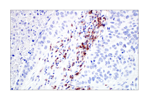  Image 68: Human Exhausted CD8+ T Cell IHC Antibody Sampler Kit