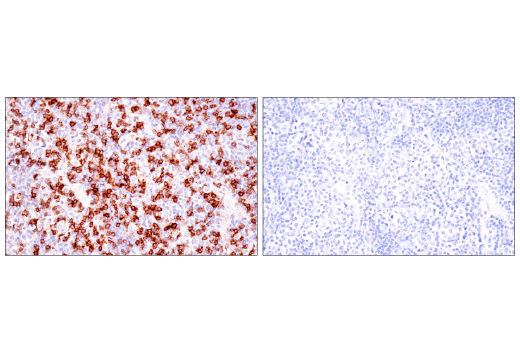  Image 76: Human Exhausted CD8+ T Cell IHC Antibody Sampler Kit