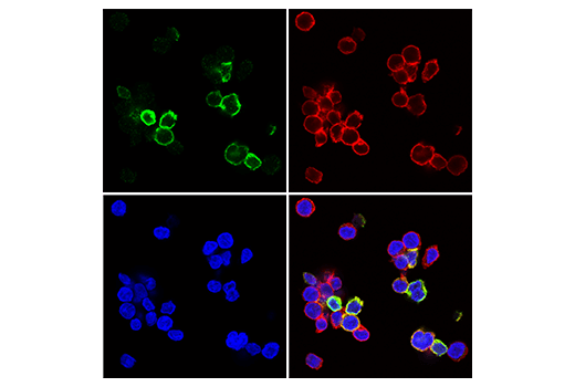 Immunofluorescence Image 1: TIGIT (E5Y1W) XP® Rabbit mAb
