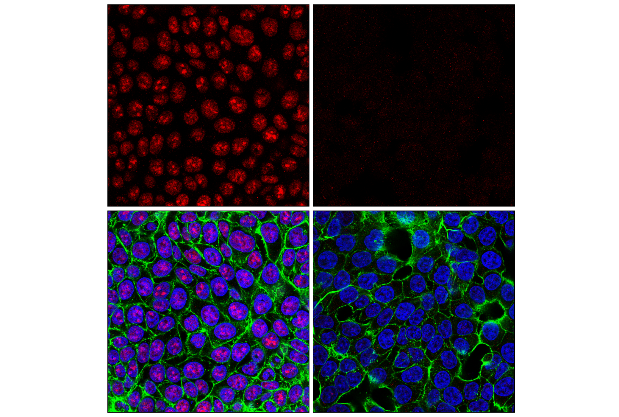 Immunofluorescence Image 1: ADAR1 (E6X9R) XP® Rabbit mAb (Alexa Fluor® 647 Conjugate)