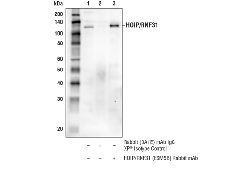 Immunoprecipitation Image 1: HOIP/RNF31 (E6M5B) Rabbit mAb