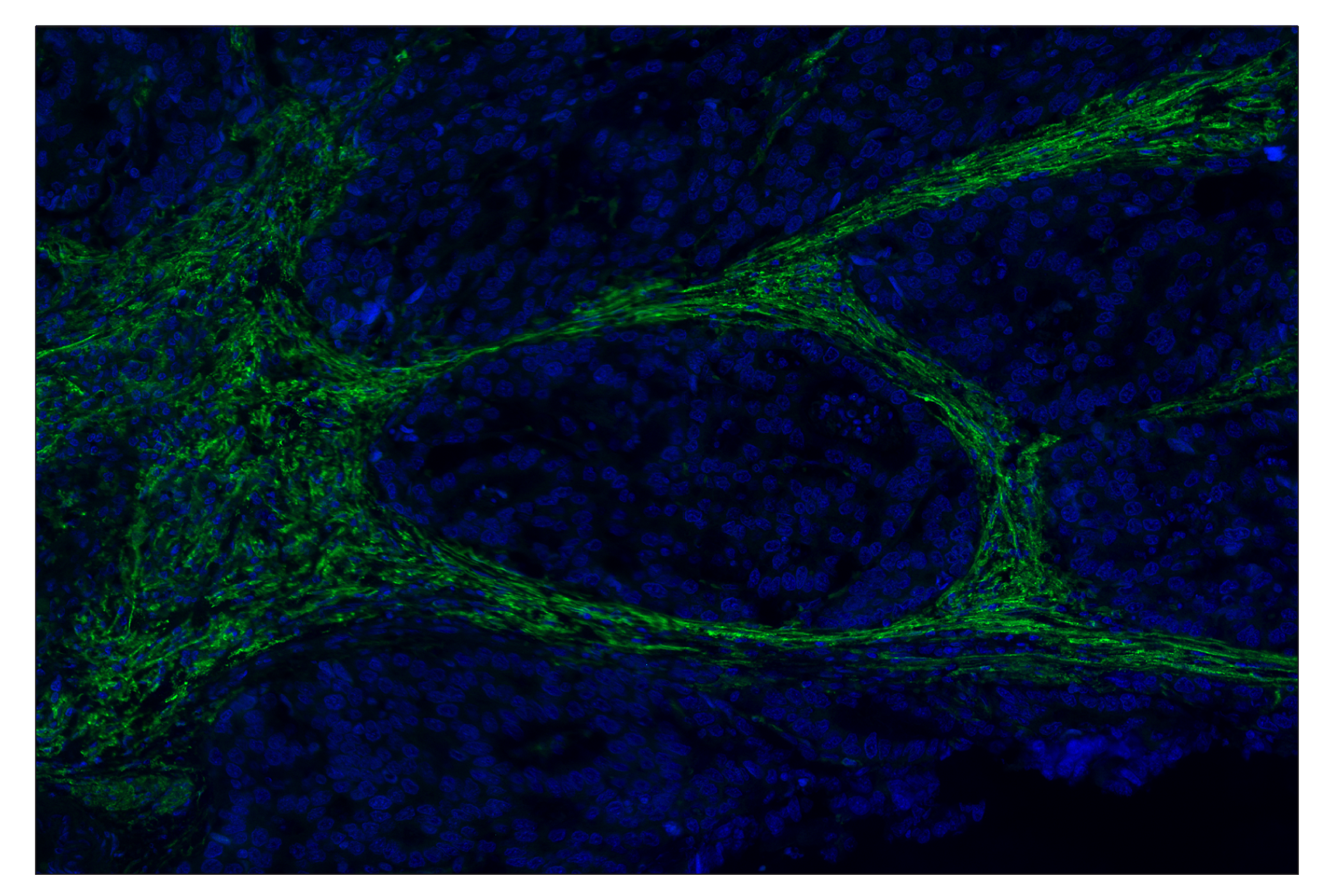 Immunohistochemistry Image 2: Podoplanin (LpMab-12) & CO-0199-594 SignalStar<sup>®</sup> Oligo-Antibody Pair