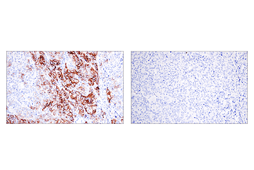  Image 72: Small Cell Lung Cancer Biomarker Antibody Sampler Kit
