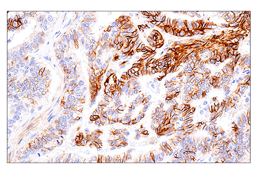 Immunohistochemistry Image 4: NCAM1 (CD56) (E7X9M) XP® Rabbit mAb