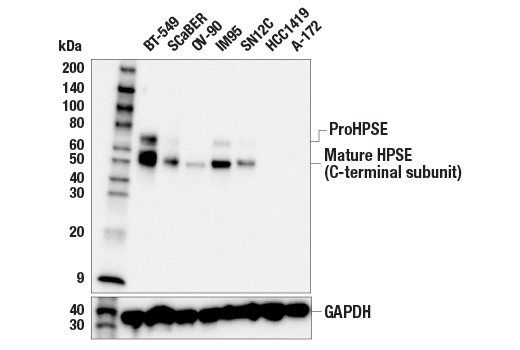 HPSE (E3N3H) Rabbit mAb | Cell Signaling Technology