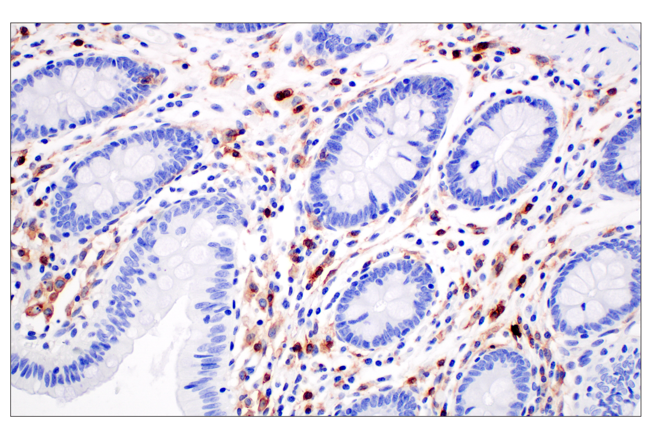 Immunohistochemistry Image 8: CD4 (MSVA-004R) Rabbit mAb