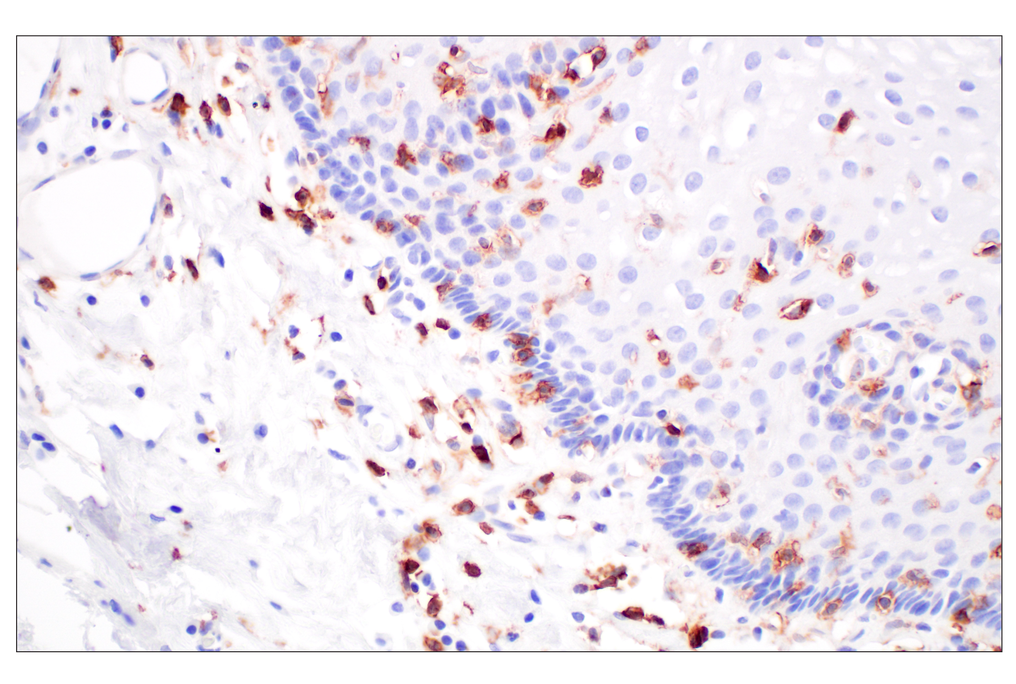 Immunohistochemistry Image 7: CD4 (MSVA-004R) Rabbit mAb