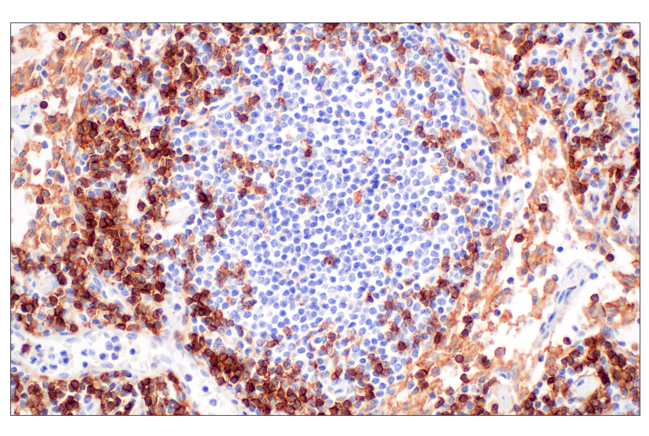 Immunohistochemistry Image 6: CD4 (MSVA-004R) Rabbit mAb