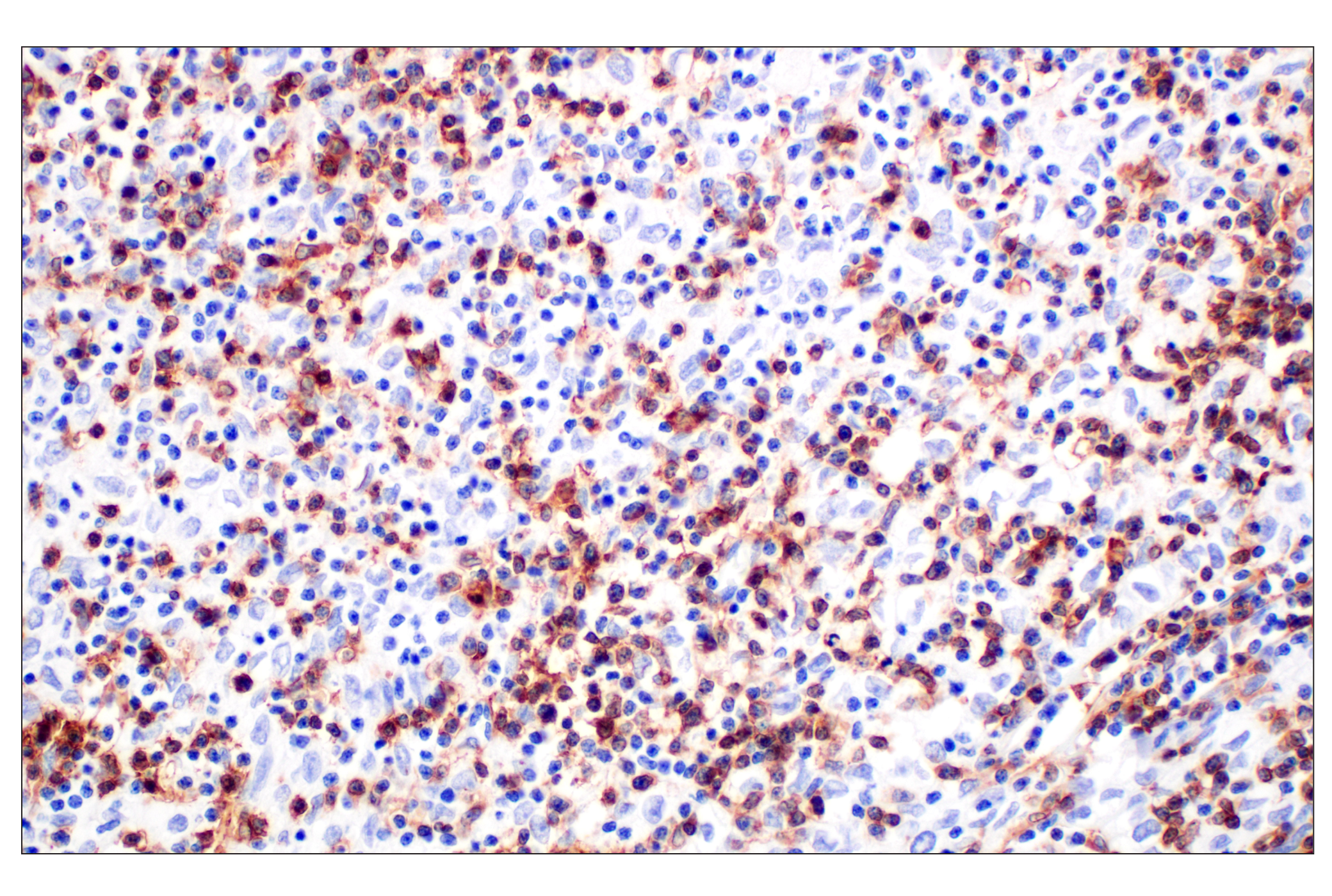 Immunohistochemistry Image 1: CD4 (MSVA-004R) Rabbit mAb