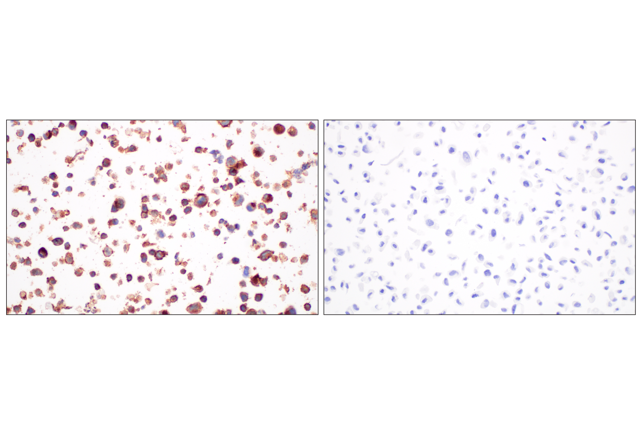 Immunohistochemistry Image 9: CD4 (MSVA-004R) Rabbit mAb