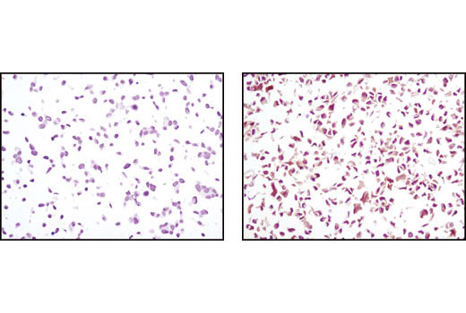 Immunohistochemistry Image 7: PTEN (D4.3) XP® Rabbit mAb (BSA and Azide Free)