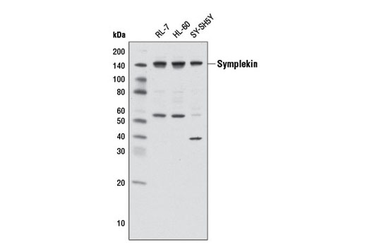 Western Blotting Image 1: Symplekin Antibody