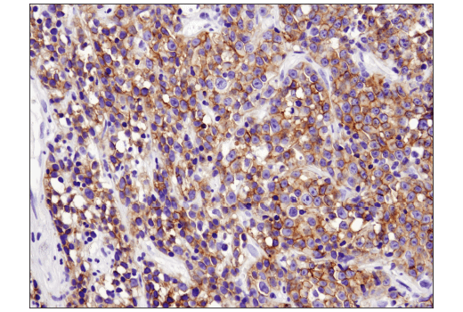 Immunohistochemistry Image 1: CXCR5 (D6L3C) Rabbit mAb (IHC Specific) (BSA and Azide Free)