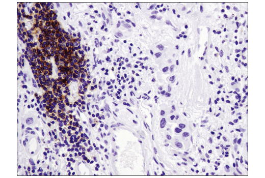 Immunohistochemistry Image 3: CXCR5 (D6L3C) Rabbit mAb (IHC Specific) (BSA and Azide Free)