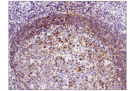 Immunohistochemistry Image 2: CXCR5 (D6L3C) Rabbit mAb (IHC Specific) (BSA and Azide Free)