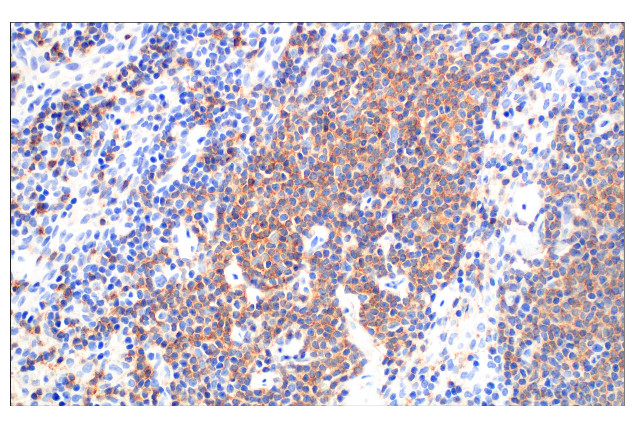 Immunohistochemistry Image 1: CXCR5 (D6L3C) Rabbit mAb (BSA and Azide Free)