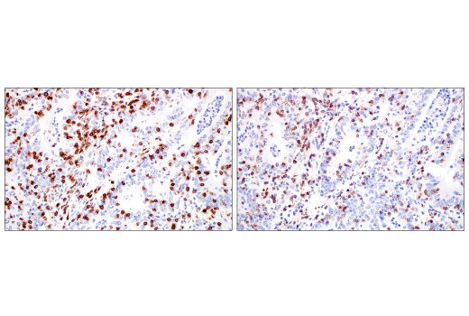 Immunohistochemistry Image 3: CD2 (D6V9F) Rabbit mAb