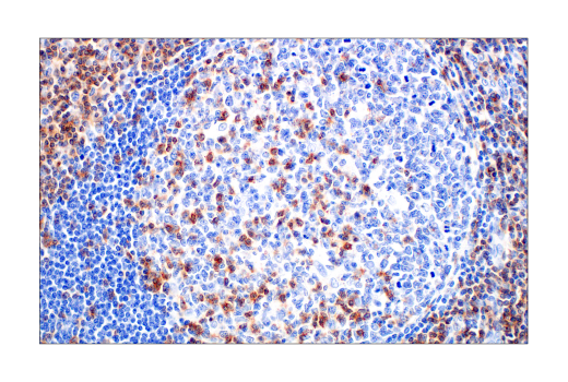 Immunohistochemistry Image 10: CD2 (D6V9F) Rabbit mAb