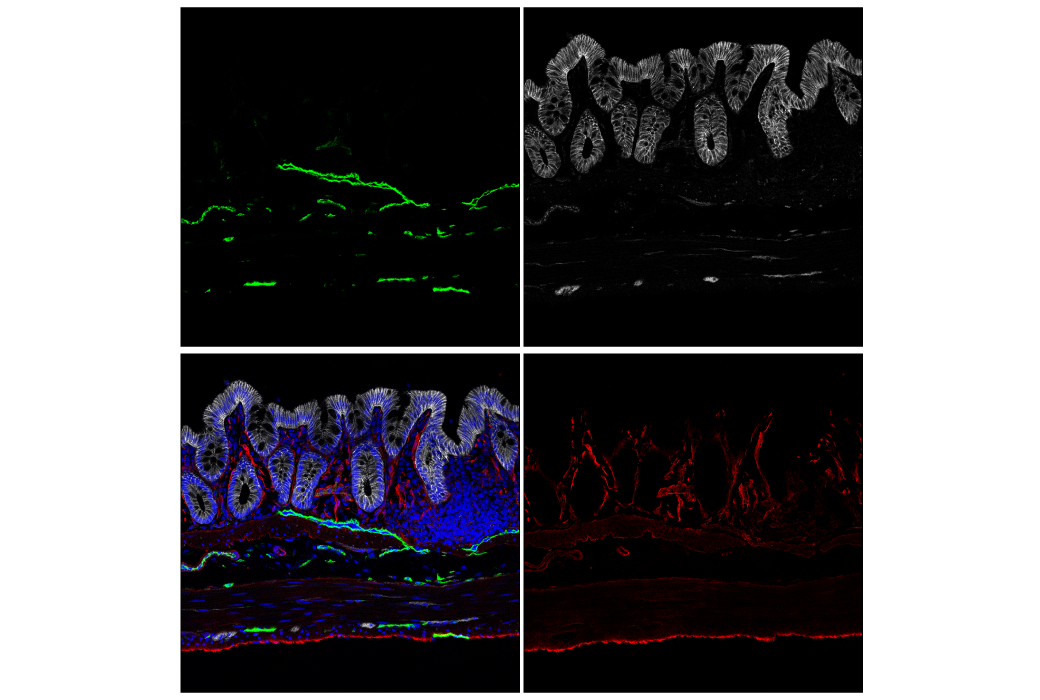 Immunofluorescence Image 2: LYVE-1 (E3L3V) Rabbit mAb (BSA and Azide Free)