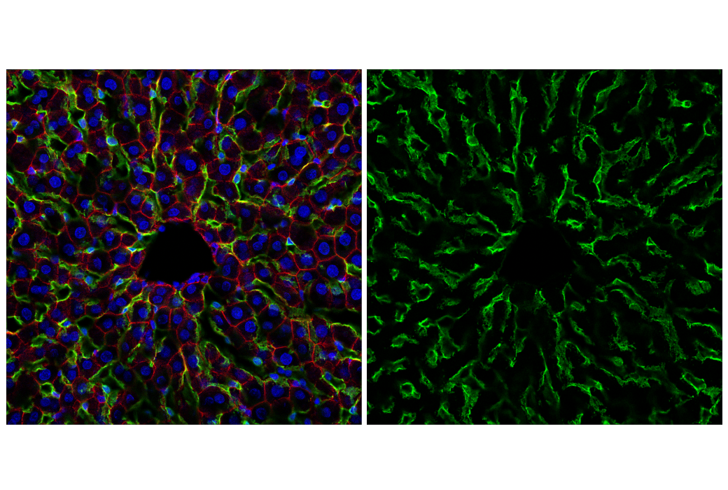 Immunofluorescence Image 4: LYVE-1 (E3L3V) Rabbit mAb (BSA and Azide Free)