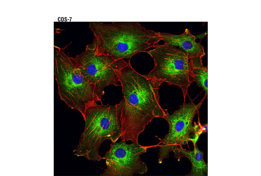 Immunofluorescence Image 1: LysRS (D16D1) Rabbit mAb
