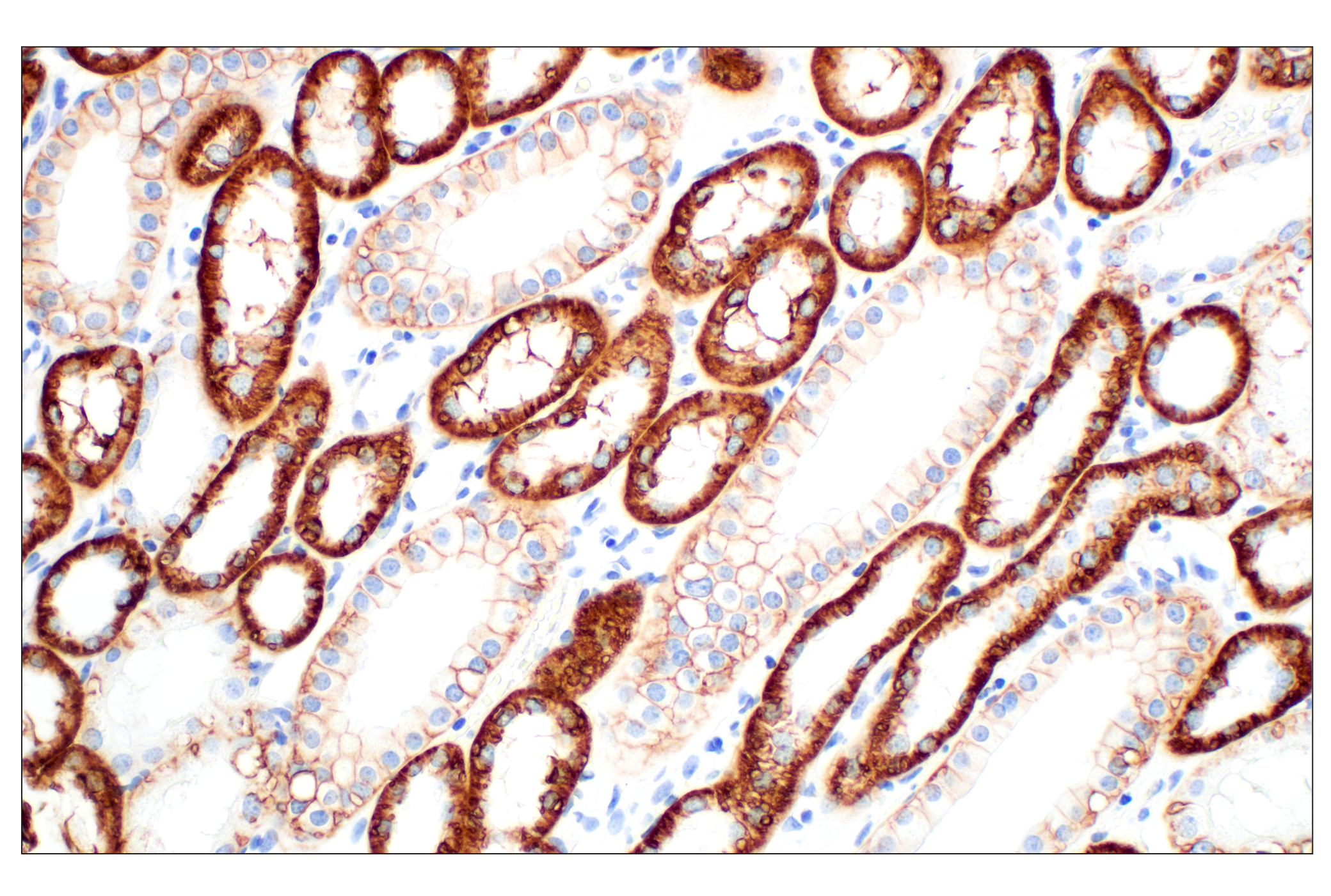 Immunohistochemistry Image 3: Na,K-ATPase alpha1 (D4Y7E) Rabbit Monoclonal Antibody (BSA and Azide Free)