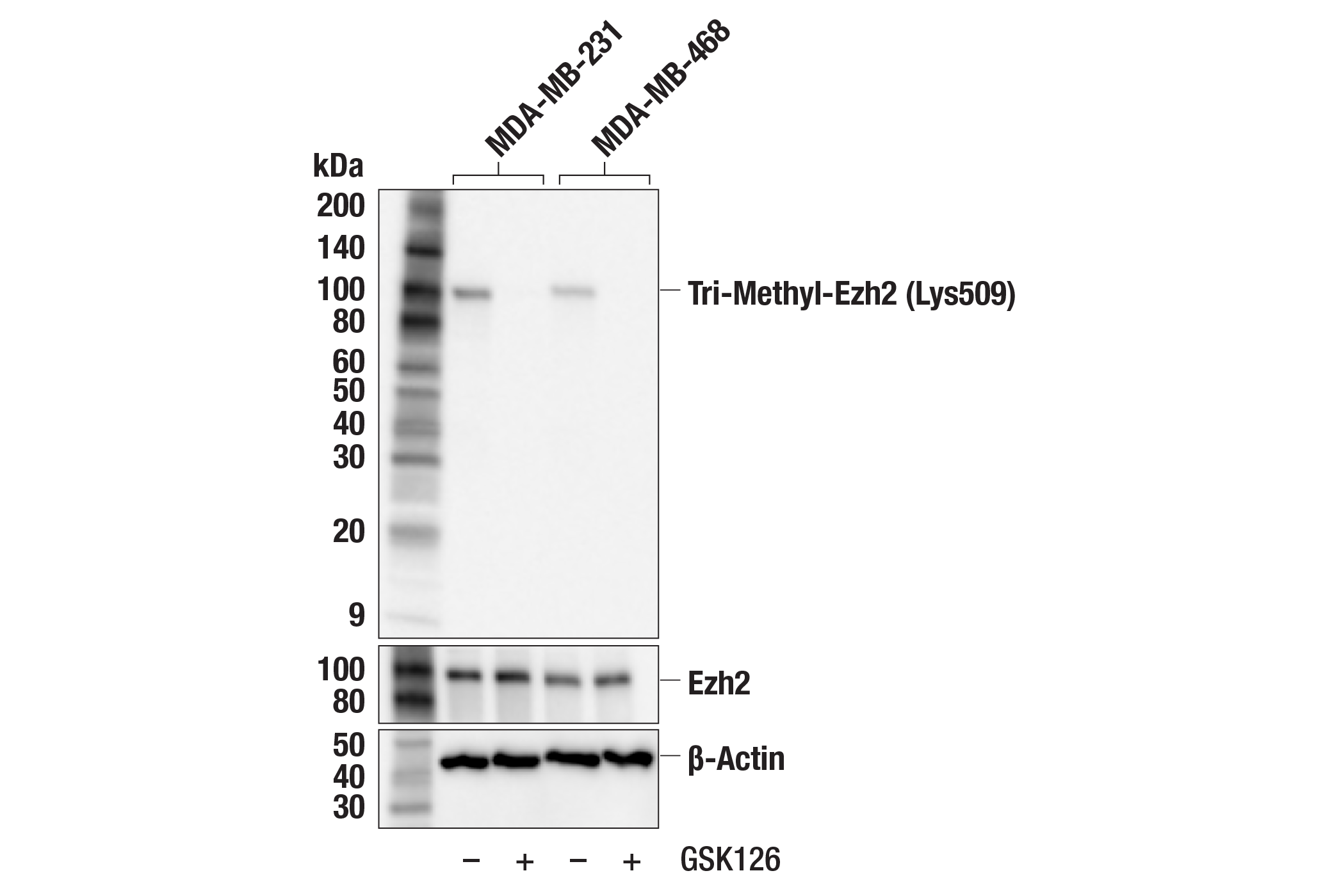 Western Blotting Image 1: Tri-Methyl-Ezh2 (Lys509) (F1D1Q) Rabbit mAb