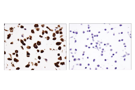 Immunohistochemistry Image 3: Fascin (55K-2) Mouse mAb (IHC Formulated)