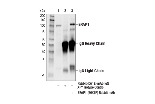 Immunoprecipitation Image 1: ERAP1 (E6X1P) Rabbit mAb