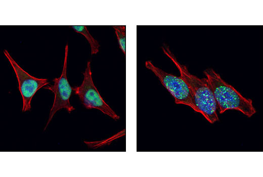 RPA70/RPA1 Antibody | Cell Signaling Technology